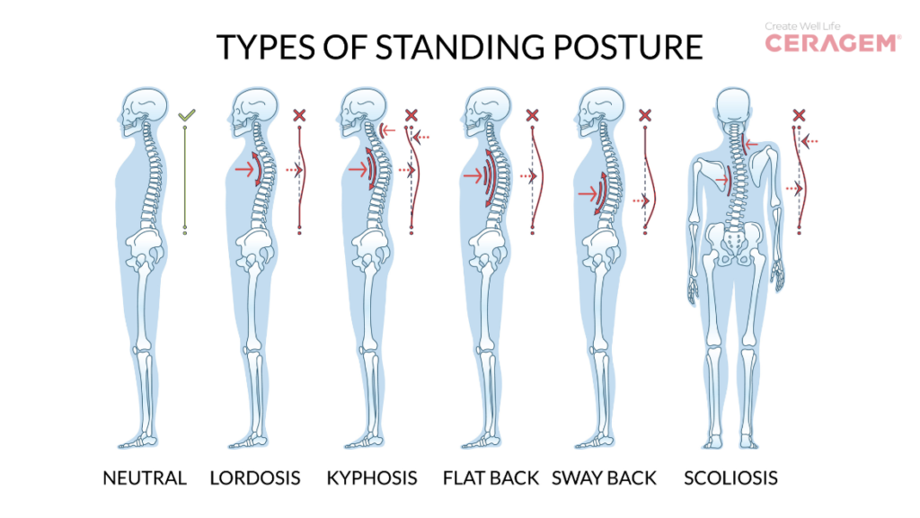 Type of Standing Posture